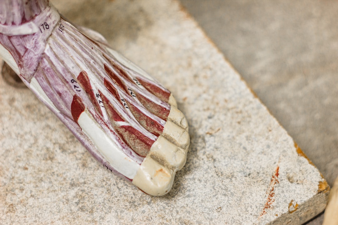plantar fascia anatomy diagram, heel pain foot structure