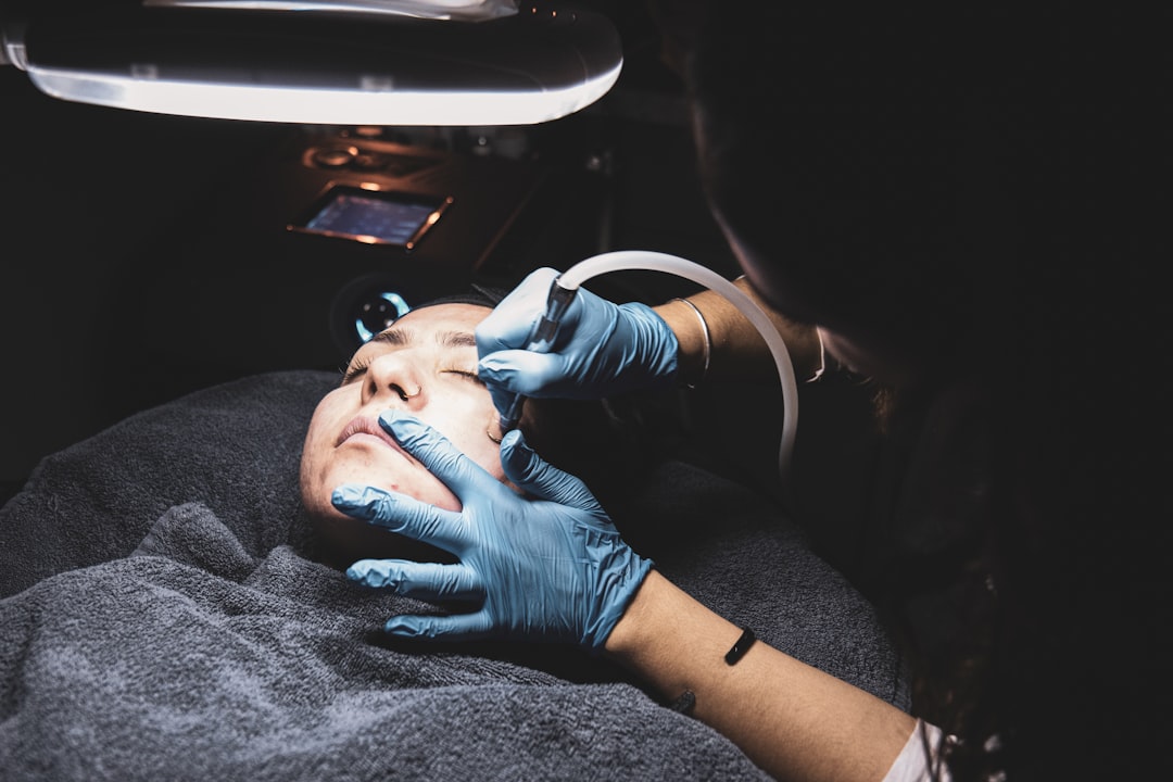 professional microneedling treatment clinic, before after skin results